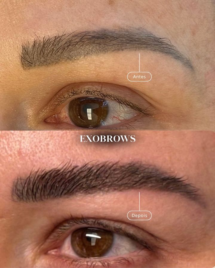 ExoBrows antes e depois