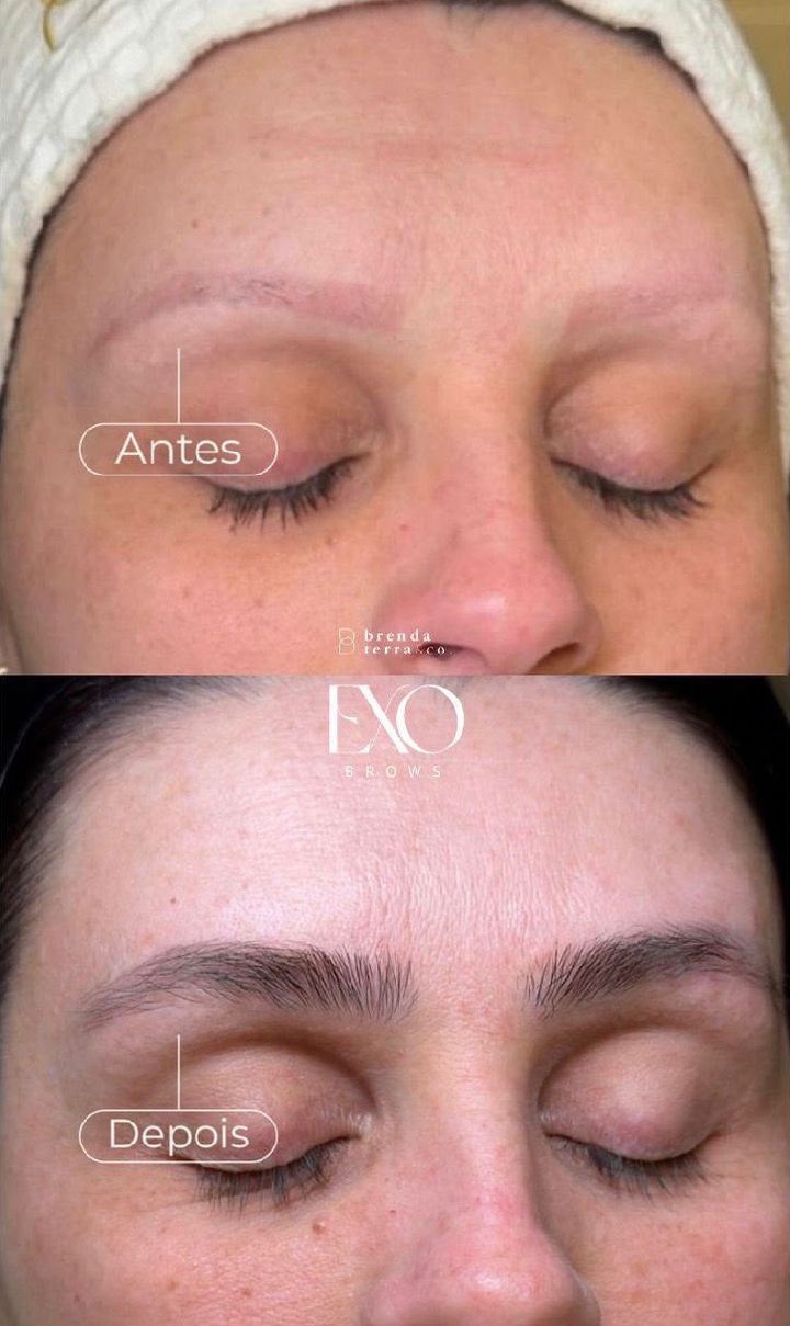 ExoBrows antes e depois