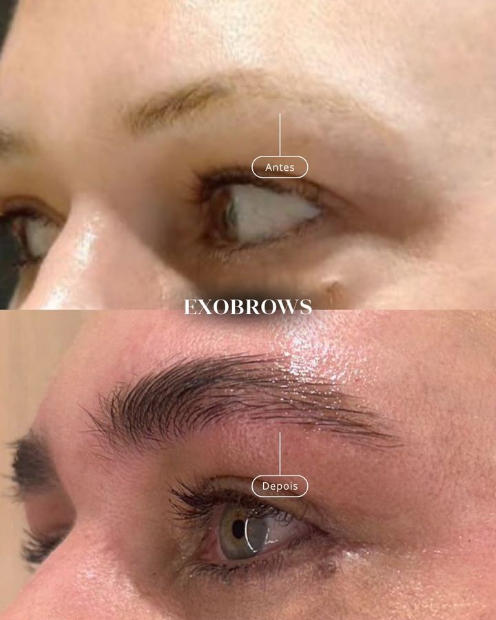 ExoBrows antes e depois
