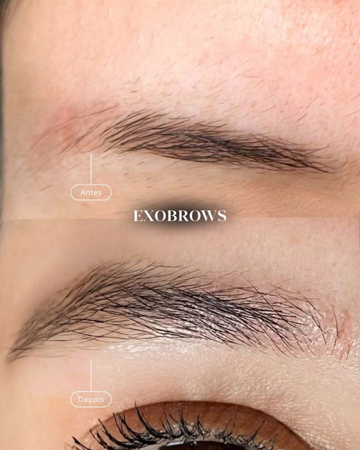 ExoBrows antes e depois