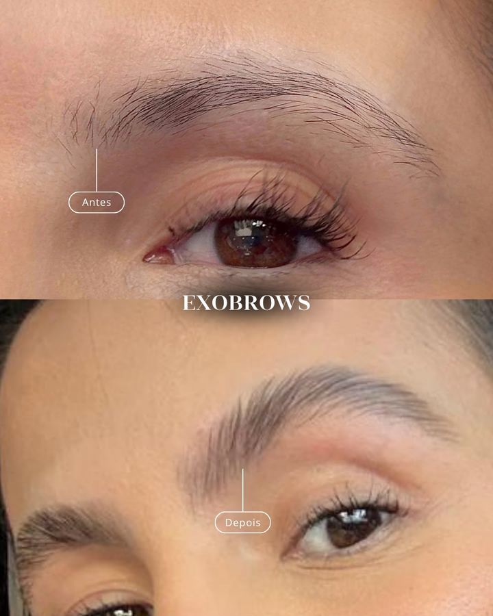 ExoBrows antes e depois