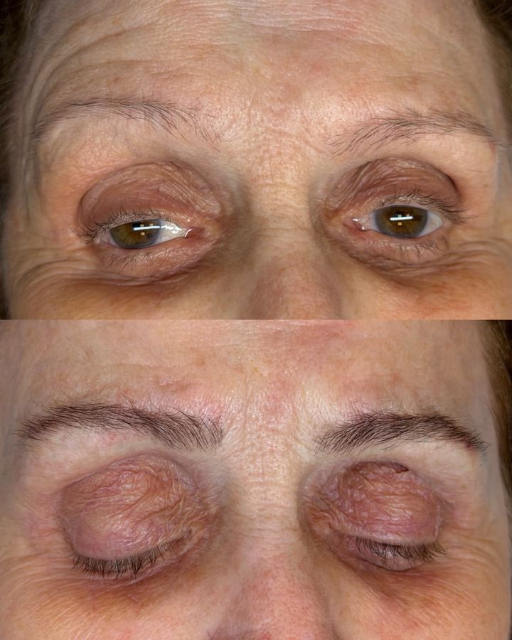 ExoBrows antes e depois