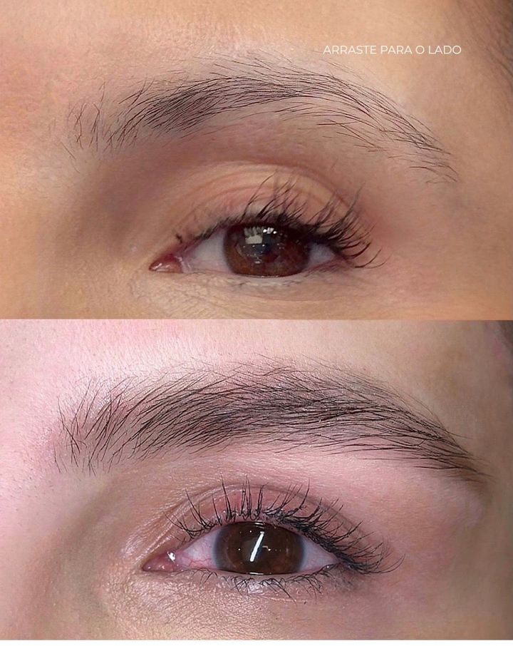 ExoBrows antes e depois