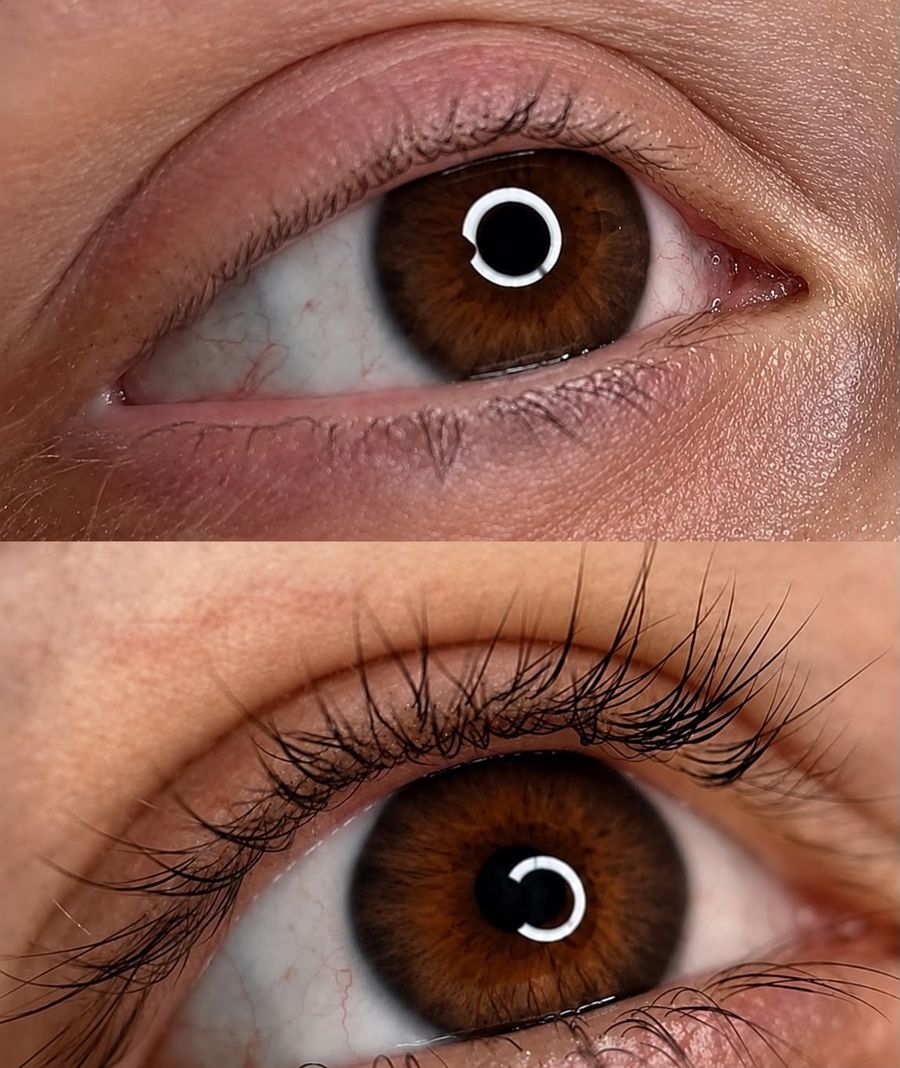 Antes e depois de cílios tratados com ExoCílios